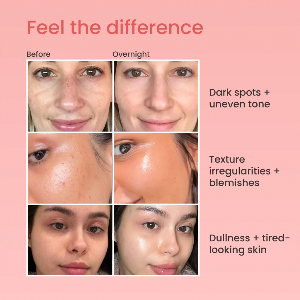 Overnight Skin Reset™